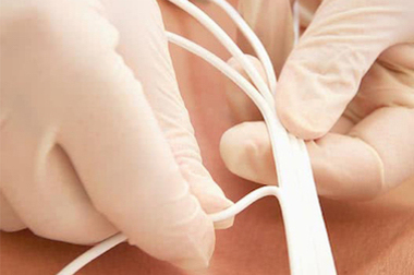 Image of Philips Replacement ECG Single-Patient US Lead Wires - Non-OEM, Medical Grade, High-Quality