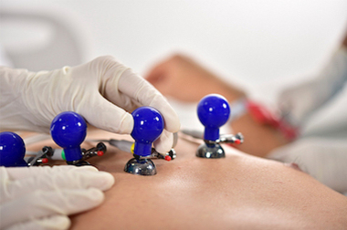 Image of EKG Orantech Chest Suctions - Non-OEM, High-Quality and Reliable for EKG Systems