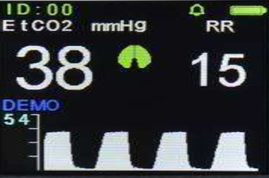 Image of ETCO2 Orantech ETCO2 Products - Non-OEM, High-Quality for ETCO2 Monitoring